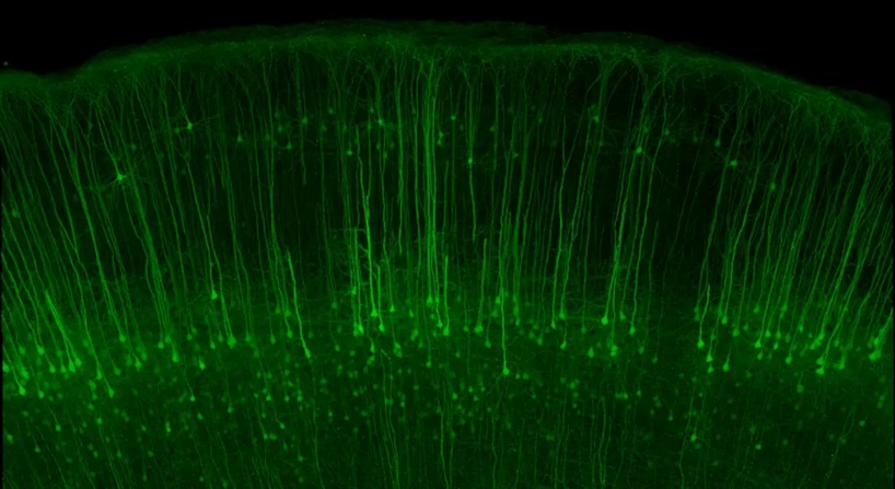 Evident is setting a new standard in life science imaging with its launch of the new FLUOVIEW™ FV5000 confocal and multiphoton laser scanning microscope