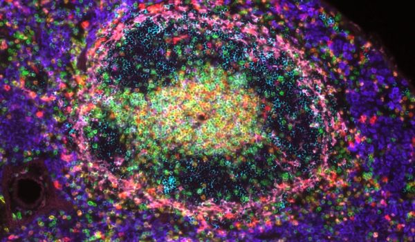 Mouse spleen stained with DAPI and antibodies